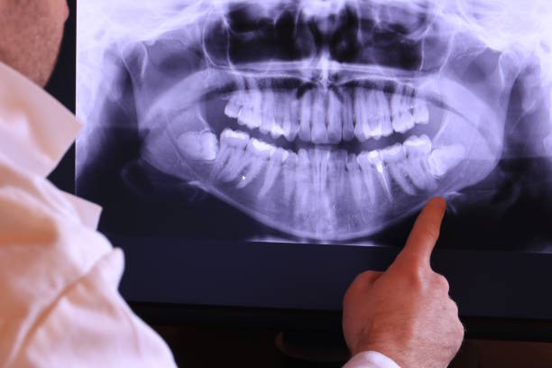 Best Dental Abscess Treatment in Church Rock, NM