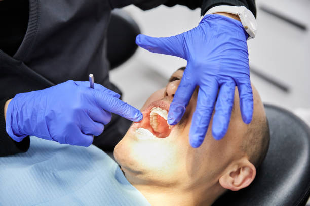 Best Emergency Dental Care for Sports Injuries in Church Rock, NM